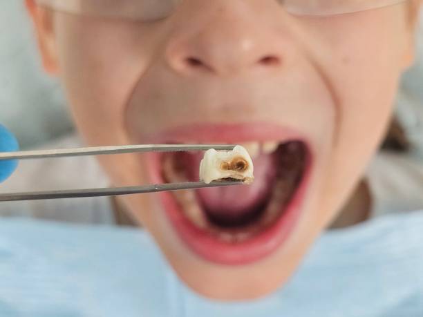 Best After-Hours Emergency Dentist in Becker, MN